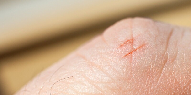 print-management-outfit-papercut-is-under-0-day-attack,-and-it’s-drawing-customers’-blood print-management-outfit-papercut-is-under-0-day-attack,-and-it’s-drawing-customers’-blood